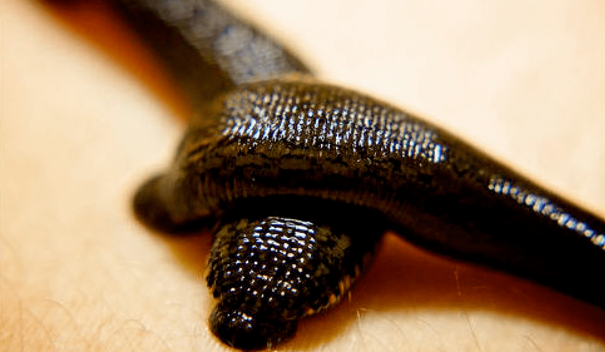 Leeches for the treatment of prostatitis