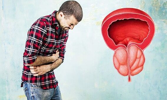 Symptoms of prostate inflammation in men